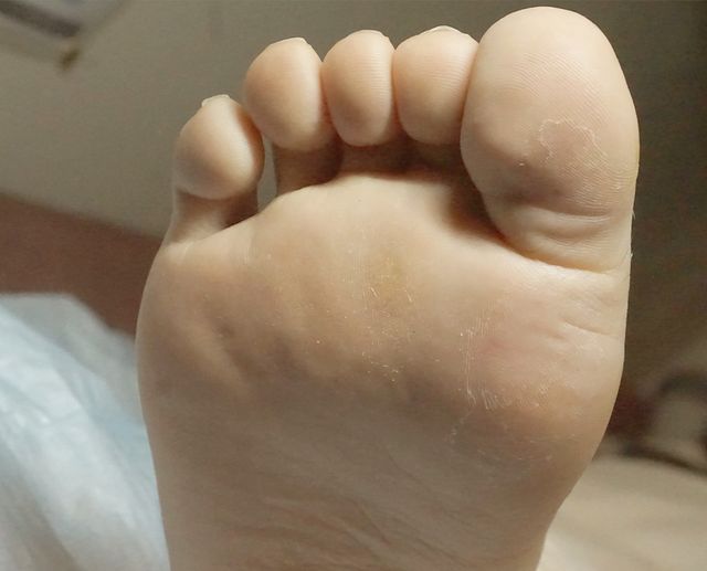 33세 남성 · 8개월 경과