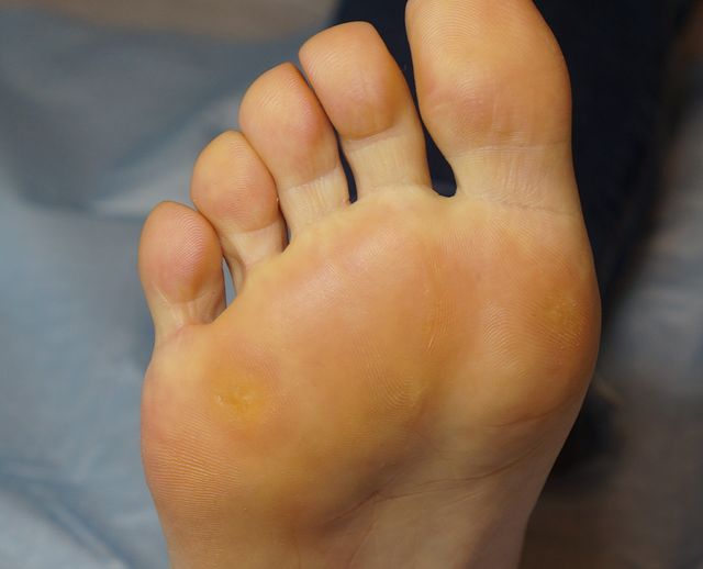 35세 여성 · 8개월 경과