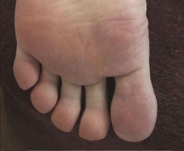 58세 남성 · 27개월 경과